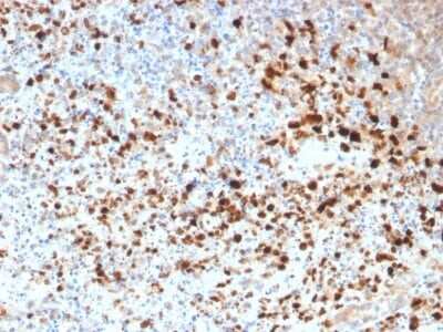 Immunohistochemistry-Paraffin: Herpes Simplex Virus 1 Antibody - Azide and BSA Free [NBP3-08600]